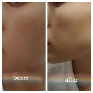 🅖🅤🅩🅔🅛 salonのエステ・リラクイメージ