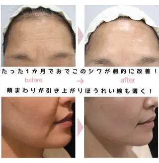 Binosu所属・エンダモロジー BINOSUのその他イメージ