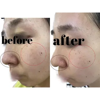 いおもり あやかのエステ・リラクイメージ