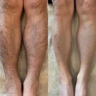 アイブロウ WAX＆光脱毛/瘦身 アイブロウ/牧野亞紀の眉毛・アイブロウイメージ