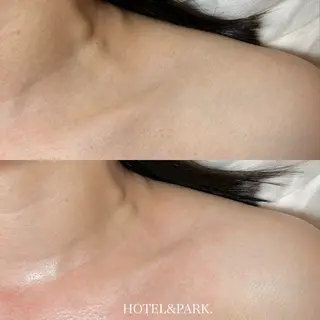 HOTEL&PARK .Moeワックス脱毛のエステ・リラクイメージ