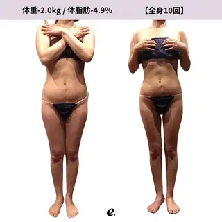 espresso,所属・《痩身、小顔専門店》 エスプレッソのエステ・リラクイメージ