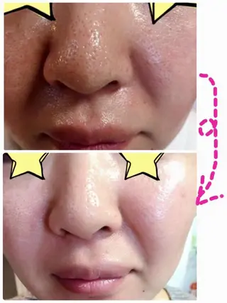 La Chance. Sayakaのエステ・リラクイメージ