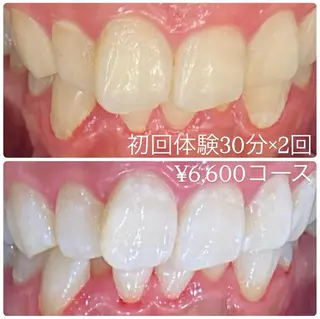 PLATINUM Beauty 横浜店所属・ホワイトニングルーム 横浜店のその他イメージ