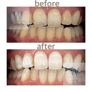 ホワイトニング ショップ船橋2号店のエステ・リラクイメージ