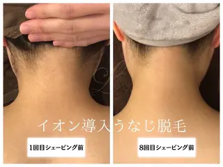 Beauty salon Lino所属・🎀うなじ脱毛🎀 ㅣLino堀江のエステ・リラクイメージ