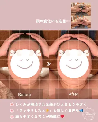 肩こり改善 専門店Fleuriのエステ・リラクイメージ