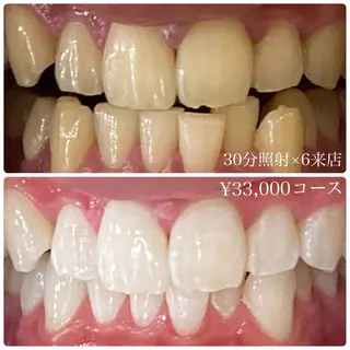 メンズ ホワイトニングルーム　川崎店所属・ホワイトニング ルーム　川崎店のその他イメージ