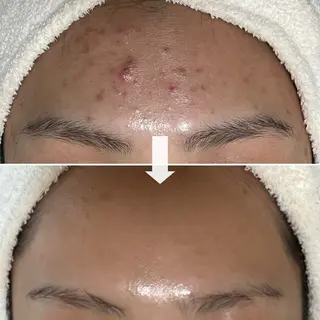 シェノン所属・ニキビ・毛穴・ フェイシャル専門店のその他イメージ