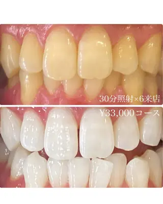 メンズ ホワイトニングルーム　川崎店所属・ホワイトニング ルーム　川崎店のその他イメージ