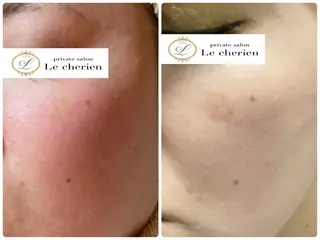 Le cherien所属・Le cherien ルシェリアのエステ・リラクイメージ