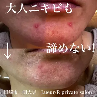 大久保 里奈のエステ・リラクイメージ