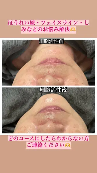 perky所属・perky 羽島のマツエク・マツパデザイン