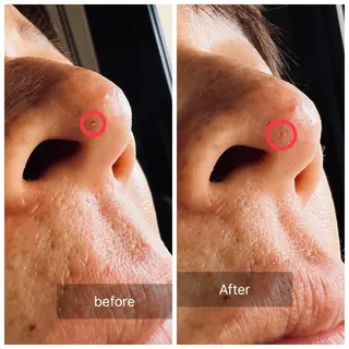 nouvelle  plume所属・ヌーベル プリュムのエステ・リラクイメージ