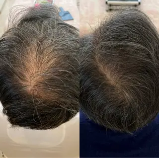 メンズ Blooming所属・LOUISE. ／肌質・頭皮のエステ・リラクイメージ