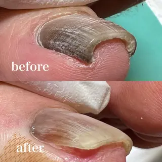 ネイル 東京巻き爪アカデミー所属・東京巻き爪 アカデミーのエステ・リラクイメージ