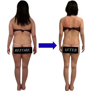 脂肪冷却/美肌改善 COCOKARAのエステ・リラクイメージ