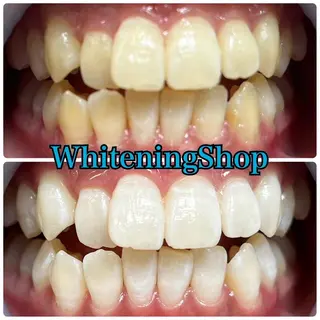 ホワイトニング ショップ吉祥寺店のエステ・リラクイメージ