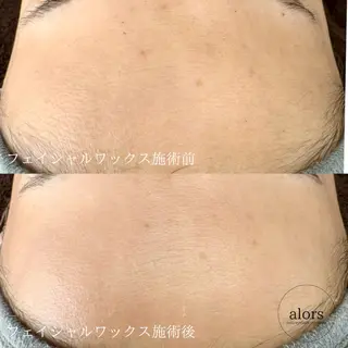 alors所属・alors shimoのマツエク・マツパデザイン