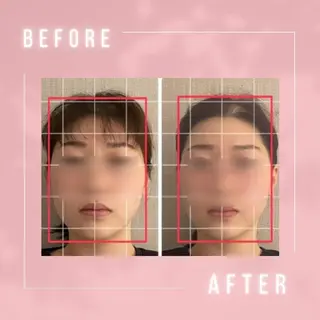 小顔・肌悩み専門店 ボーテドリッシュのエステ・リラクイメージ