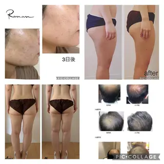 溝の口エステranan所属・化粧品成分研究/講師 ranan三浦のエステ・リラクイメージ