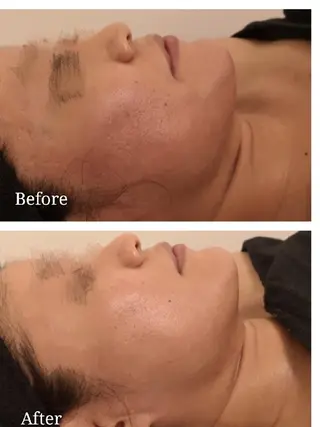 🅖🅤🅩🅔🅛 salonのエステ・リラクイメージ