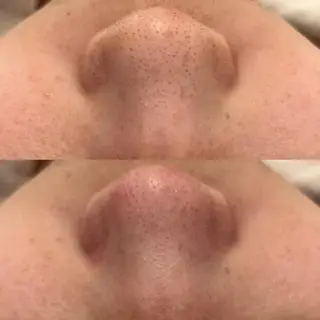 ララ/ハーブ メゾンリュバンのエステ・リラクイメージ