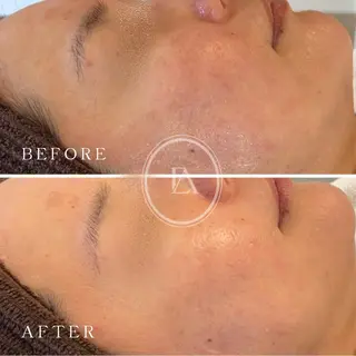 エストリア 所沢店のエステ・リラクイメージ