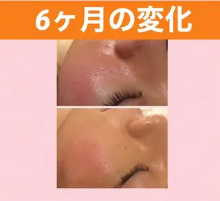 メンズ キッズ ニキビ 専門のエステ・リラクイメージ