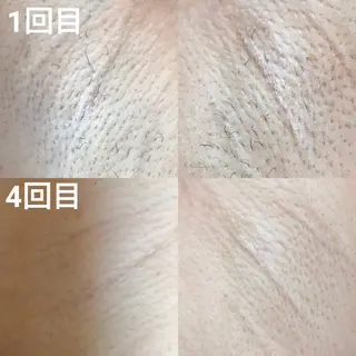 メンズ キッズ 男女同額完全個室脱毛 LEPIA内田のエステ・リラクイメージ