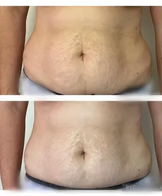 marrina terraceのその他イメージ