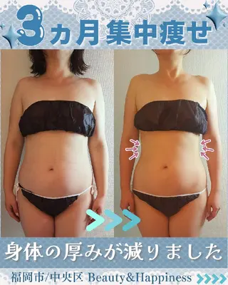 痩身ハーブピーリング 筋膜リリース☆B&Hのエステ・リラクイメージ