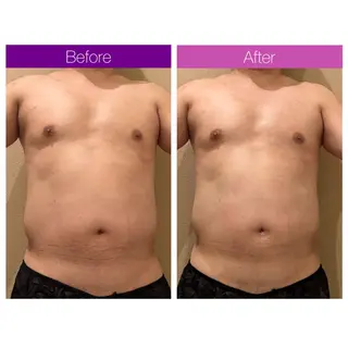 ☆痩身/小顔☆ 結果出します☆のエステ・リラクイメージ