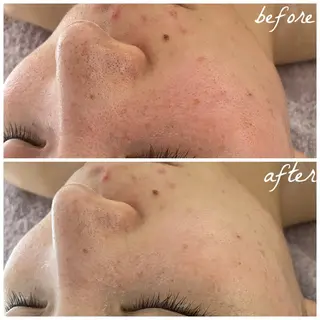 メンズ メナード岐阜市茜部 杉浦のエステ・リラクイメージ