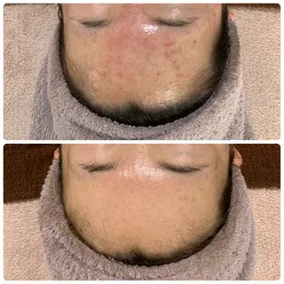 M.riche エムリシェのエステ・リラクイメージ