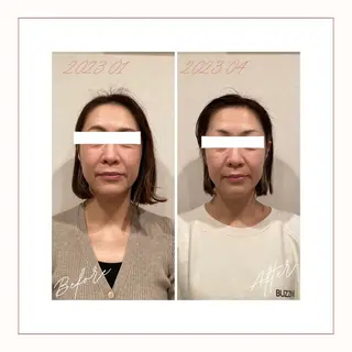 小顔×肌質改善サロン soin〔ソワン〕のエステ・リラクイメージ