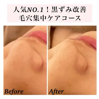 Bellesthe （ベルエステ）のエステ・リラクイメージ