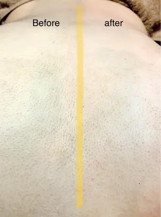 癒処 momiis 鍼灸院のエステ・リラクイメージ