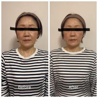 Ocouture所属・Ocouture ホワイトニング、小顔のその他イメージ