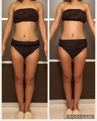 ミディアム カラー パーマ ヘアアレンジ ネイル マツエク・マツパ アニメ,Vオタク× 即効痩せエステサロンのエステ・リラクイメージ