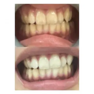 M渋谷店所属・Ｍ渋谷 ホワイトニングのエステ・リラクイメージ