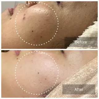 堀井 舞琳のエステ・リラクイメージ