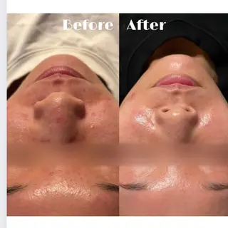 # fu♡のエステ・リラクイメージ