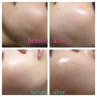 🅖🅤🅩🅔🅛 salonのエステ・リラクイメージ