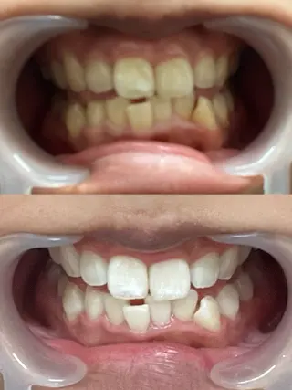 セルフホワイトニング 池袋　プラネットのその他イメージ