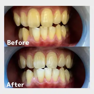 カラー メンズ キッズ あらかき 接骨院のエステ・リラクイメージ