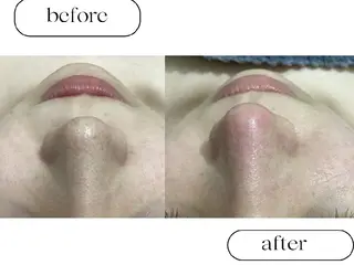 美肌専門サロン RUBONのエステ・リラクイメージ