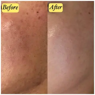 エステサロン　Sブランペタル所属・三沢市エステサロン Sブランペタルのエステ・リラクイメージ