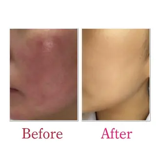 美楽鍼 びらくしんのその他イメージ