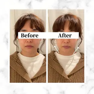 12Dハイフ💗 最強小顔のエステ・リラクイメージ